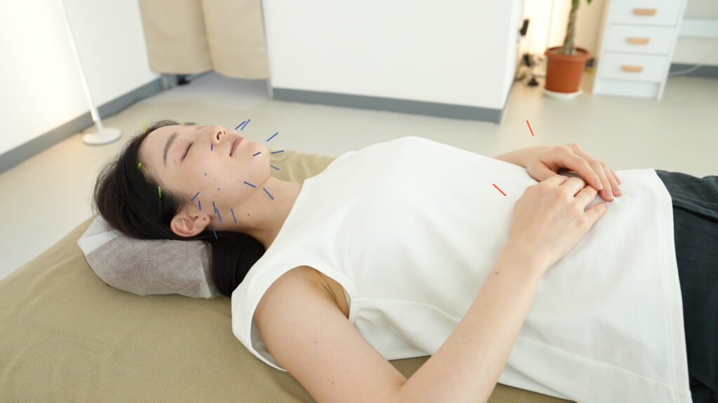お顔だけではなく手足のツボも使って全身からアプローチする鍼灸院 Lafullの美容鍼